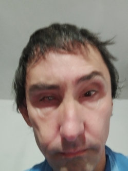 Attila, 51 �ves t�rskeres� f�rfi, Csongr�d
